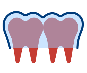 Aligners