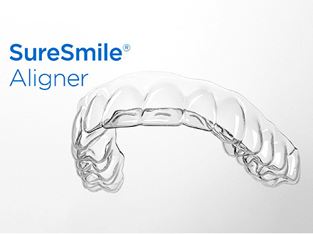 SureSmile Aligners