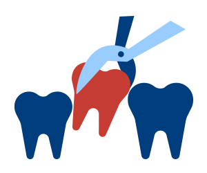 Tooth Extractions